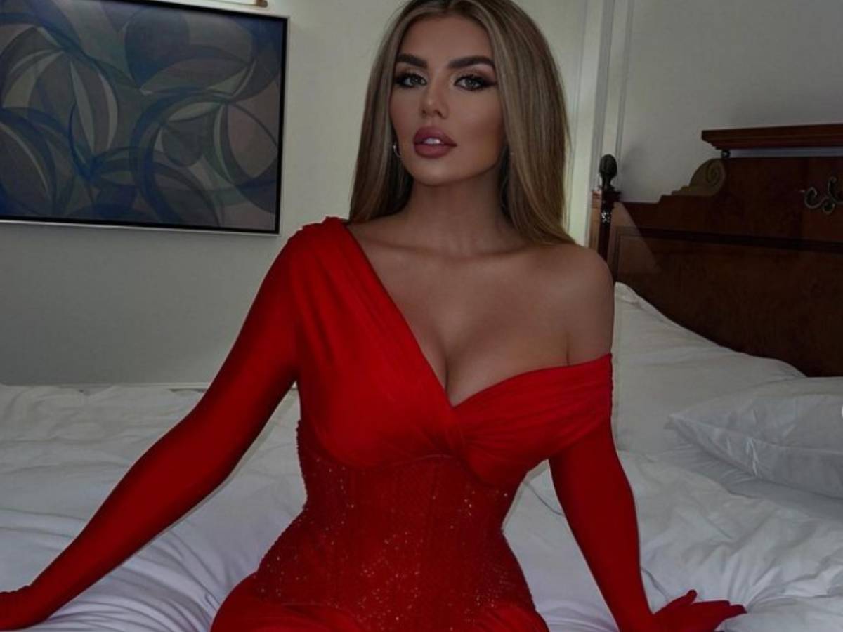 Анна Седокова Реакция на импланты: что происходит с раздувшейся до неузнаваемости Седоковой